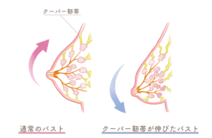 ナイトブラの効果